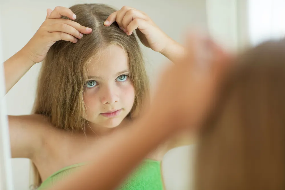 أسباب تساقط الشعر عند الأطفال بعمر 6 سنوات
